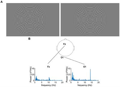 Modulation of cortical activity by spherical blur and its correlation with retinal defocus